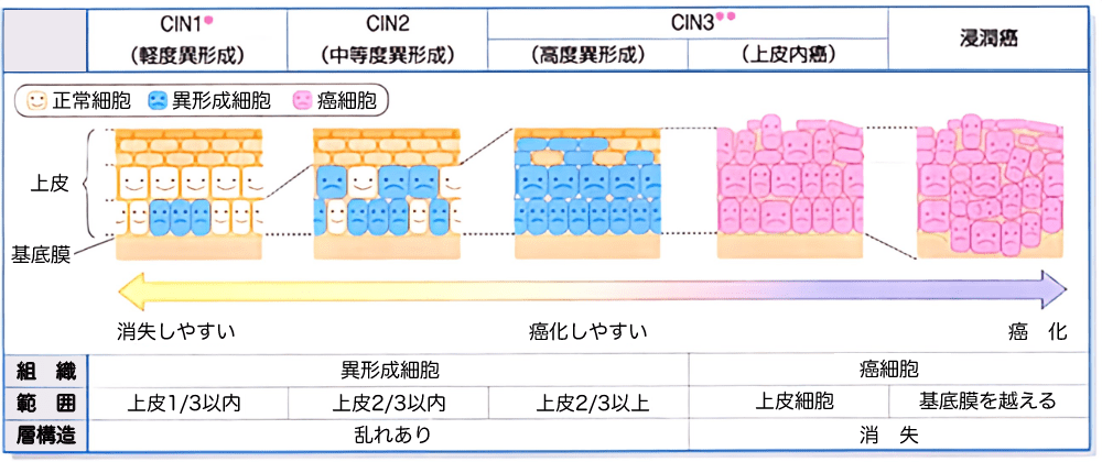 CIN分類